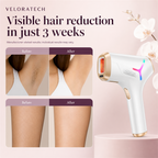 VELORATECH IPL handset — what the routine looks like over three weeks