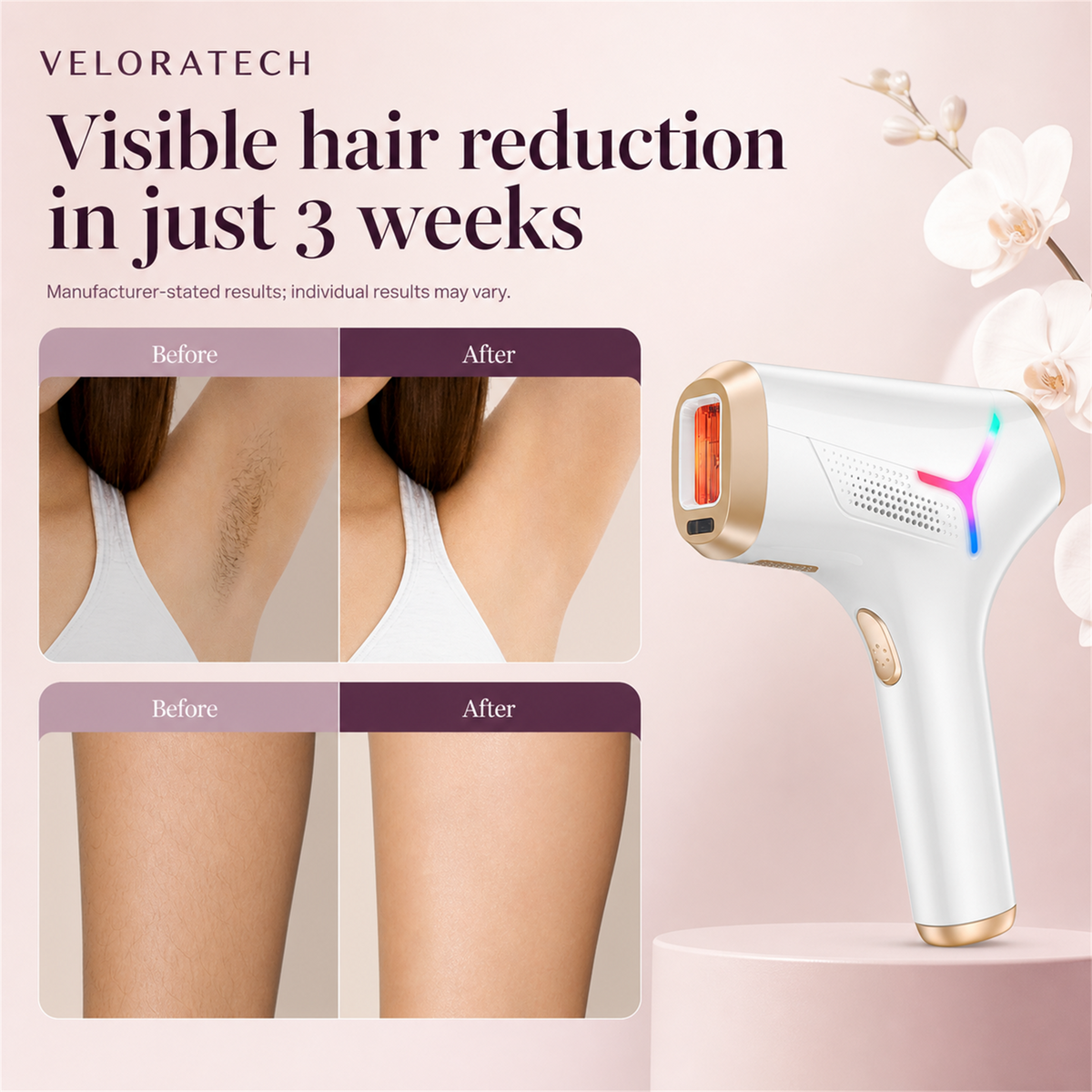 VELORATECH IPL handset — what the routine looks like over three weeks